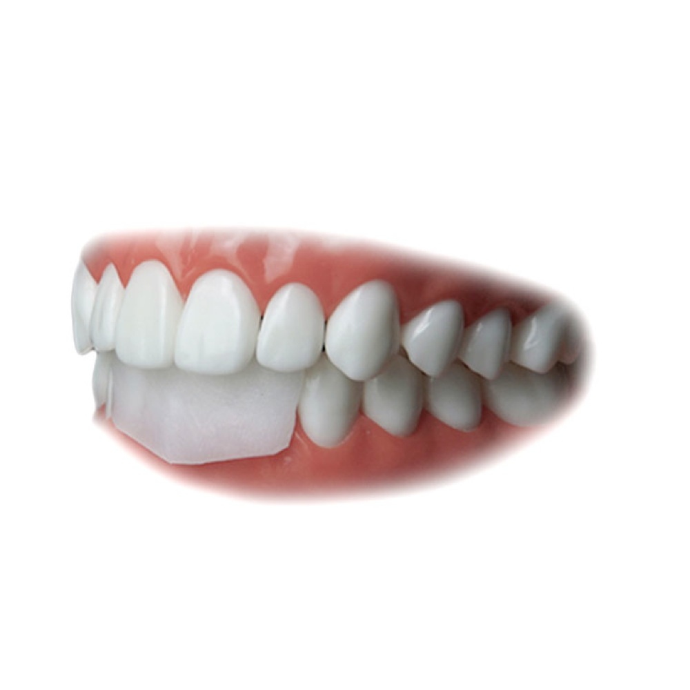 SILVERSTEIN OG01D OMNIGUARD リッププロテクター 2枚入り リッププロテクター 装着時 画像